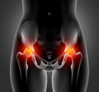 biaya hip replacement